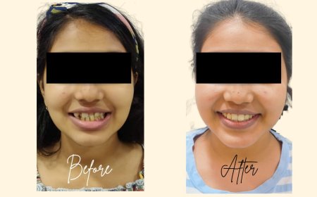 Teeth Care Multispeciality Dental Clinic Being the Best Dental Braces Center in Kolkata