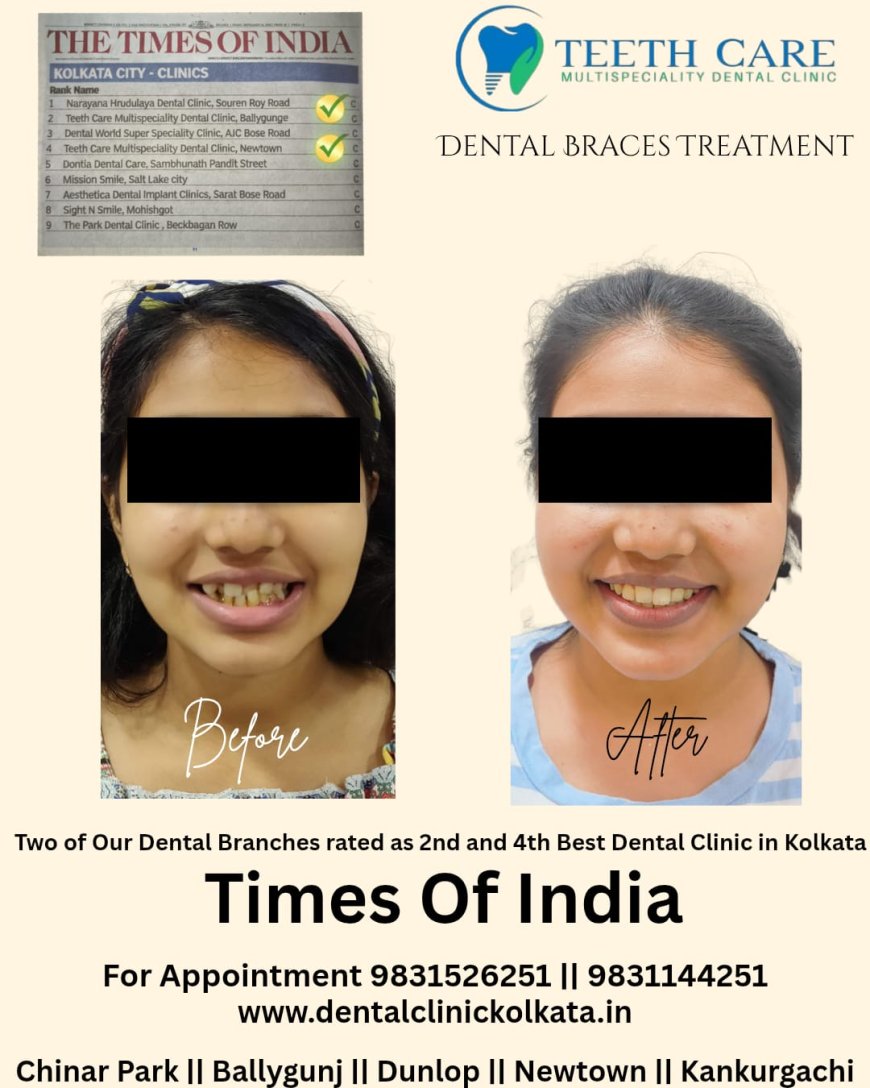 Teeth Care Multispeciality Dental Clinic Being the Best Dental Braces Center in Kolkata